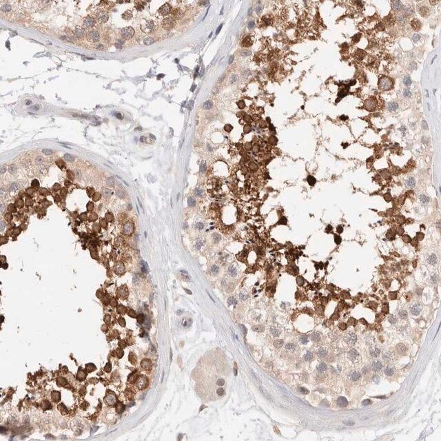 Anti-C17orf97 antibody produced in rabbit