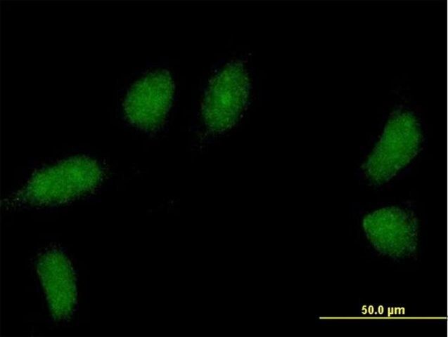 Anti-C1ORF83 antibody produced in mouse