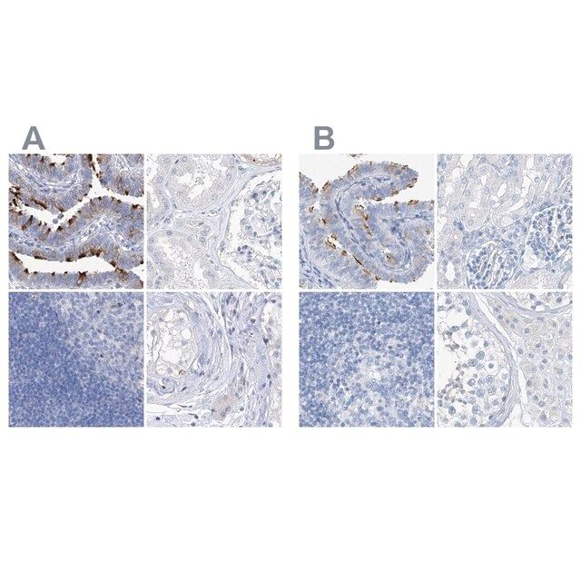 Anti-C1orf87 antibody produced in rabbit