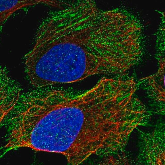 Anti-CORIN antibody produced in rabbit