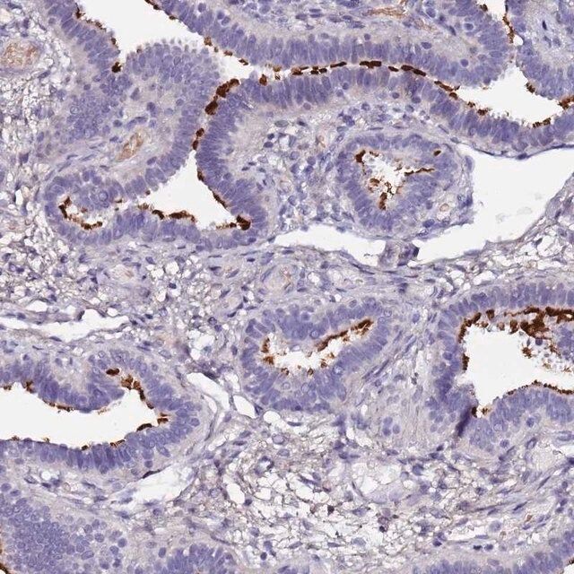 Anti-C3orf80 antibody produced in rabbit