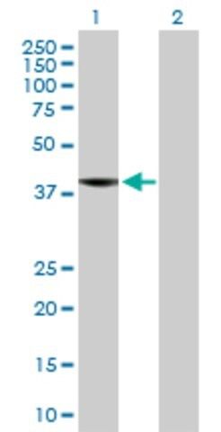 Anti-C8ORF76 antibody produced in mouse