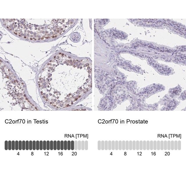 Anti-C2orf70 antibody produced in rabbit