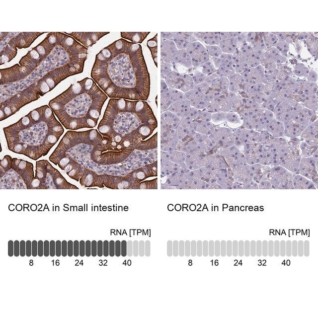 Anti-CORO2A antibody produced in rabbit