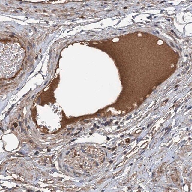 Anti-C14orf80 antibody produced in rabbit