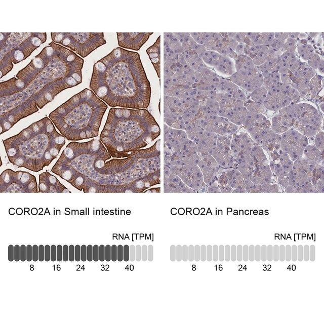 Anti-CORO2A antibody produced in rabbit