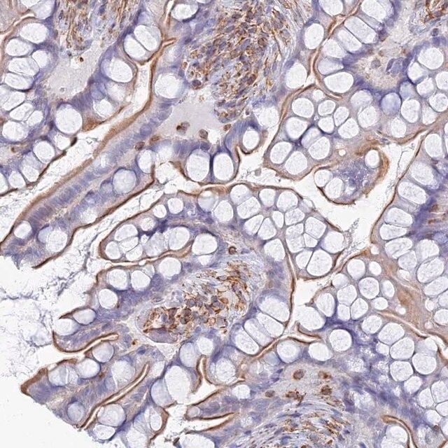 Anti-C18ORF8 antibody produced in rabbit