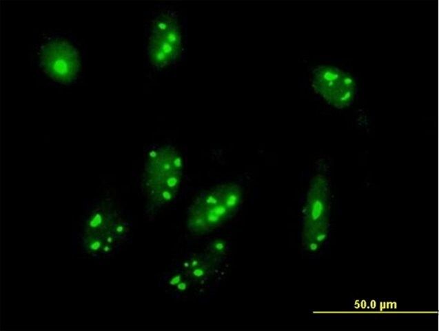 Anti-C1orf87 antibody produced in mouse