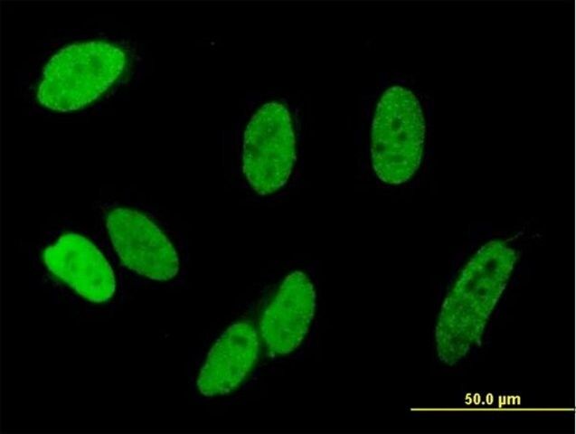 Anti-C13ORF8 antibody produced in mouse