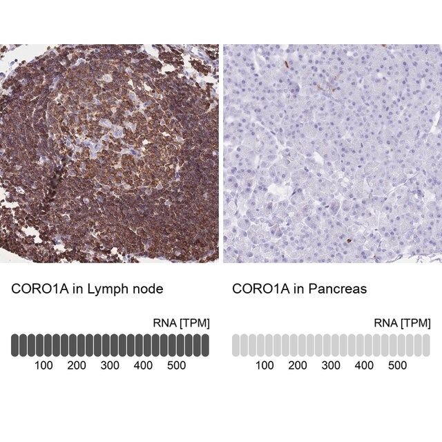 Anti-CORO1A antibody produced in rabbit