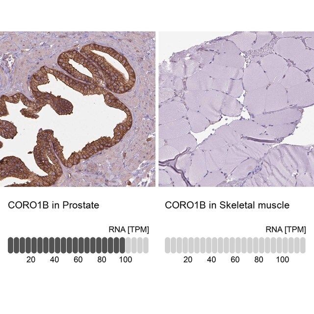 Anti-CORO1B antibody produced in rabbit