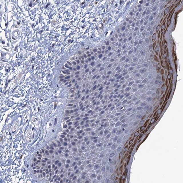 Anti-C16orf87 antibody produced in rabbit