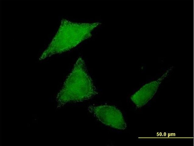 Anti-C9ORF96 antibody produced in mouse