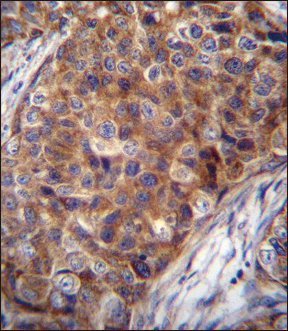 ANTI-COX7A2L (CENTER) antibody produced in rabbit