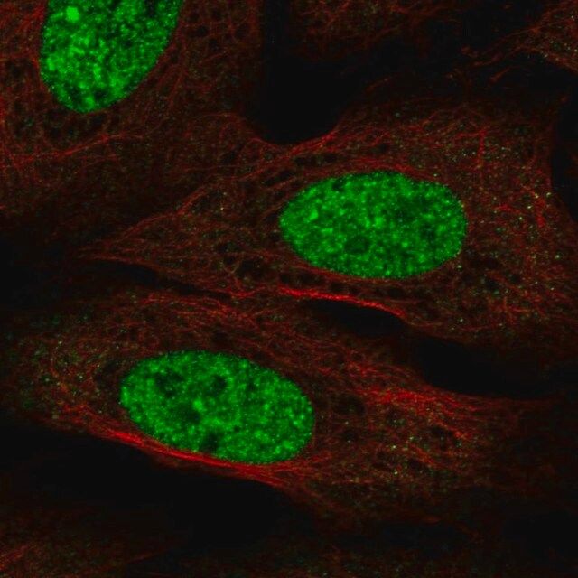 Anti-CPEB3 antibody produced in rabbit