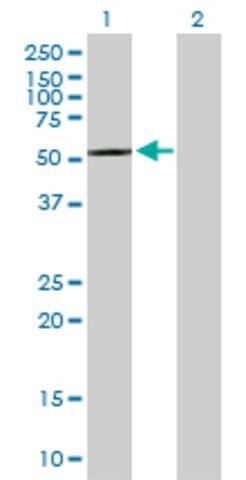 Anti-CPNE4 antibody produced in mouse