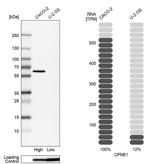 Anti-CPNE1 antibody produced in rabbit