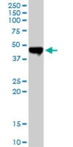 Anti-CPA2 antibody produced in rabbit