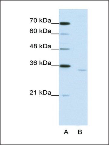 Anti-CPEB2 antibody produced in rabbit