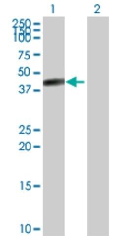 Anti-CPB1 antibody produced in rabbit