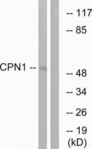 Anti-CPN1 antibody produced in rabbit