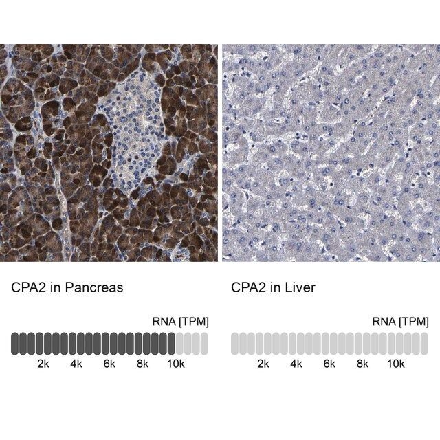 Anti-CPA2 antibody produced in rabbit