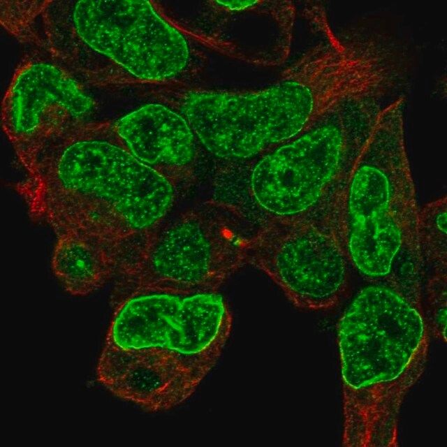 Anti-CPD antibody produced in rabbit