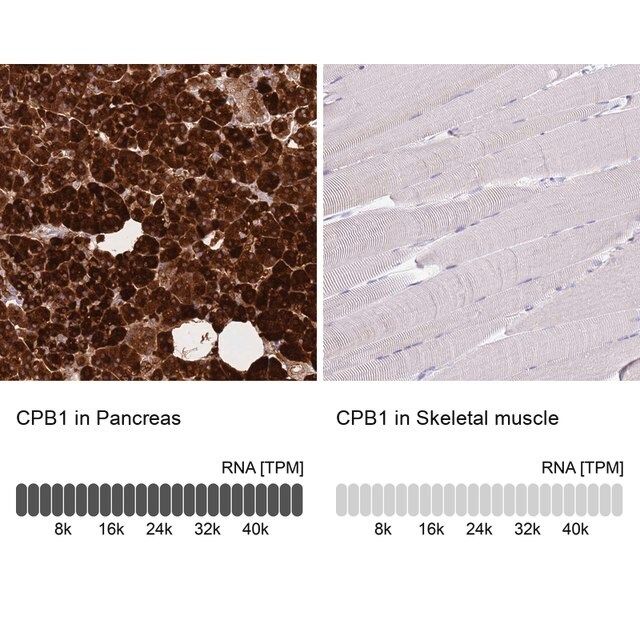 Anti-CPB1 antibody produced in rabbit