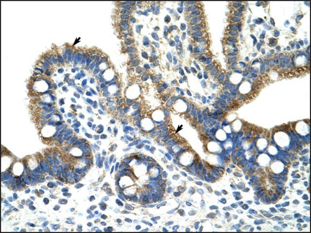 Anti-CPNE1 antibody produced in rabbit