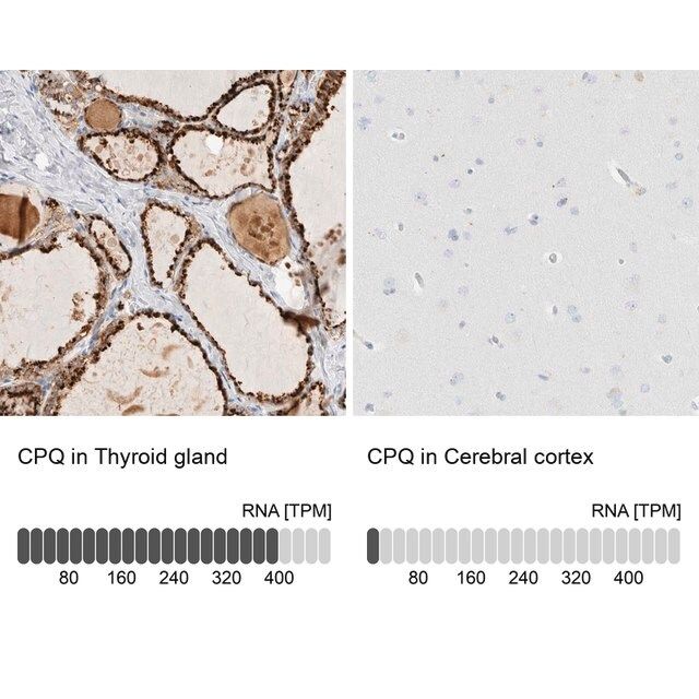 Anti-CPQ antibody produced in rabbit