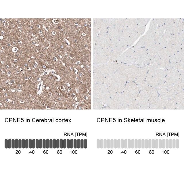 Anti-CPNE5 antibody produced in rabbit