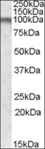 Anti-CPT1C antibody produced in goat