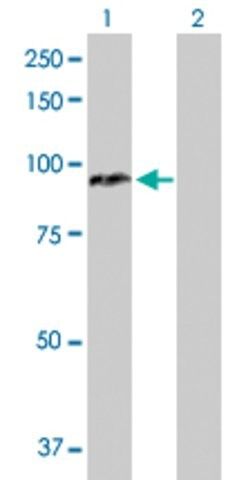 Anti-CPT1A antibody produced in rabbit