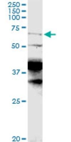 Anti-CPEB1 antibody produced in rabbit