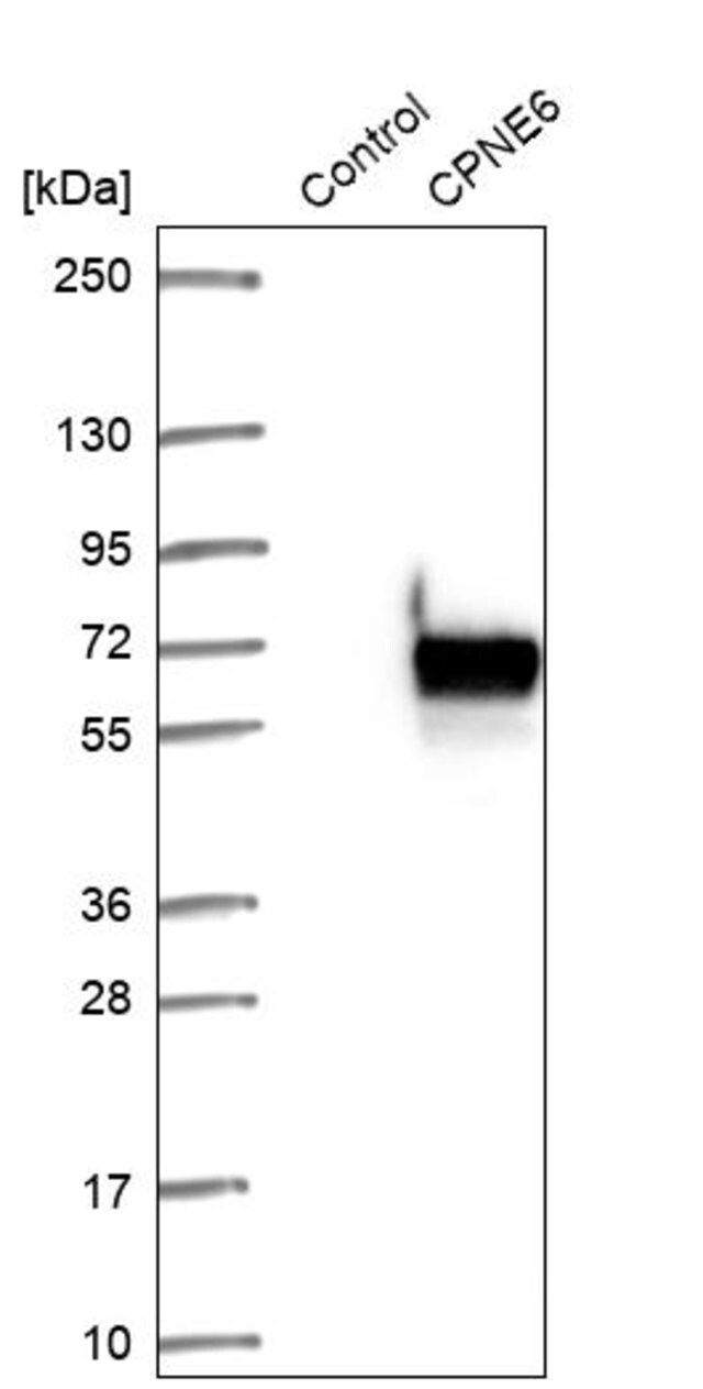 Anti-CPNE6 antibody produced in rabbit