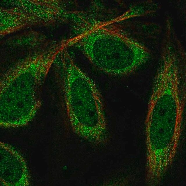 Anti-CPEB1 antibody produced in rabbit