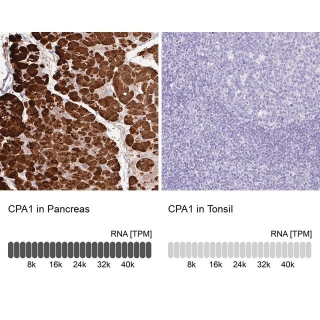 Anti-CPA1 antibody produced in rabbit