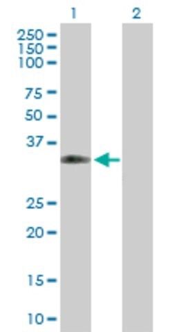 Anti-CPNE5 antibody produced in mouse