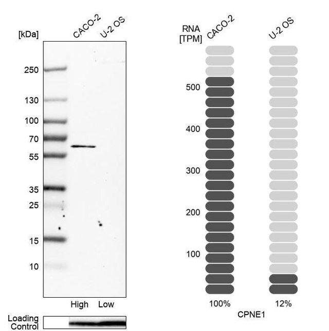 Anti-CPNE1 antibody produced in rabbit