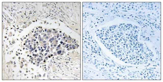 Anti-CPNE8 antibody produced in rabbit