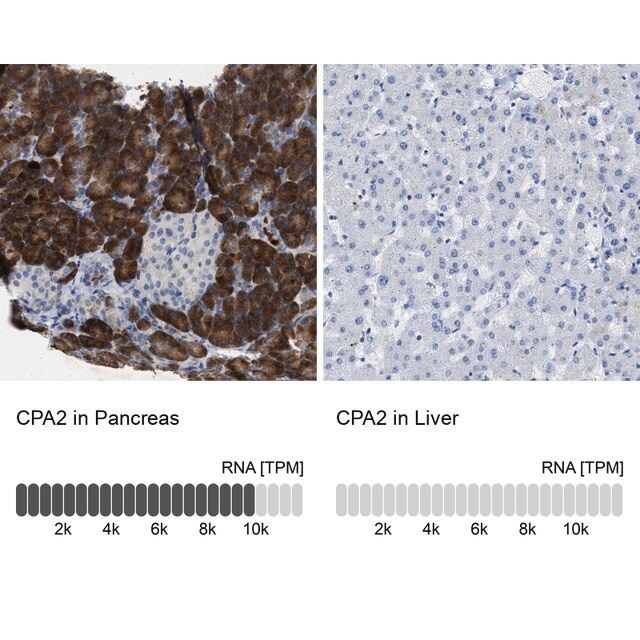 Anti-CPA2 antibody produced in rabbit