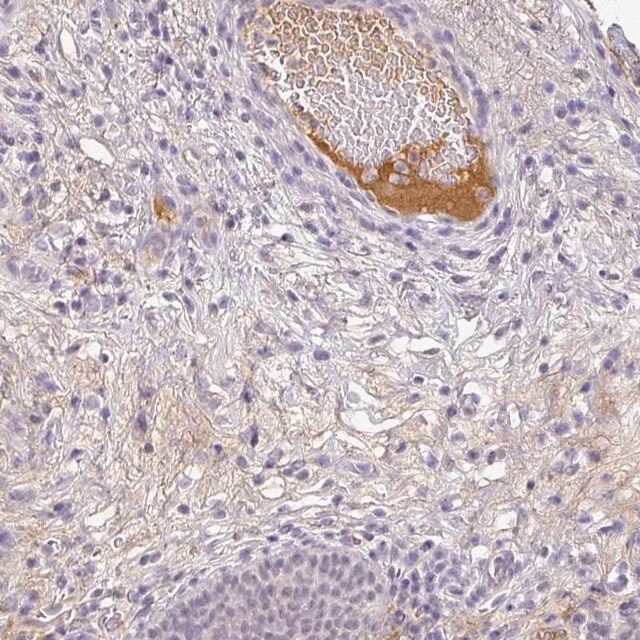 Anti-C1QB antibody produced in rabbit