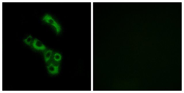 Anti-C1QB, C-Terminal antibody produced in rabbit