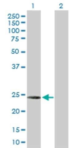 Anti-C1QC antibody produced in rabbit