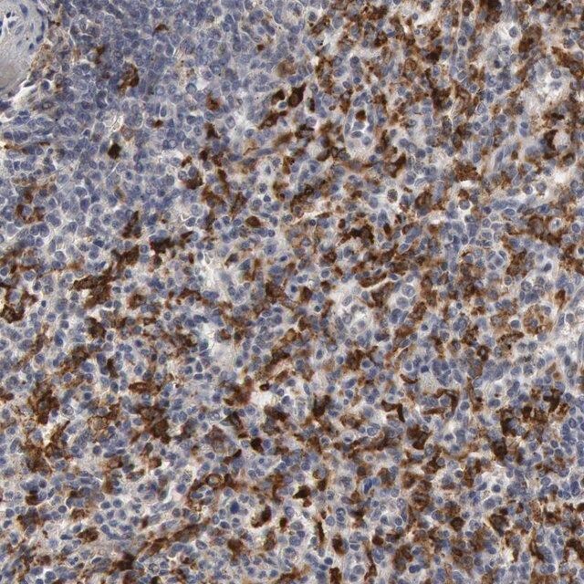 Anti-C1QC antibody produced in rabbit