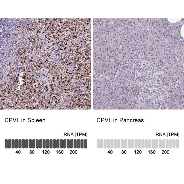 Anti-CPVL antibody produced in rabbit