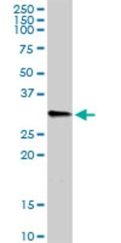 Anti-C1QB antibody produced in rabbit