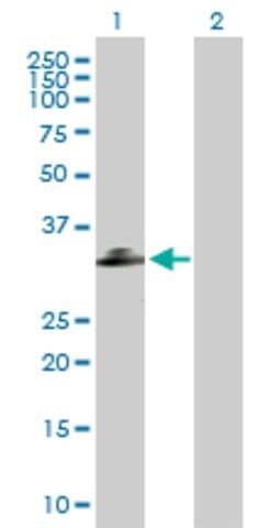 Anti-C1QTNF2 antibody produced in mouse