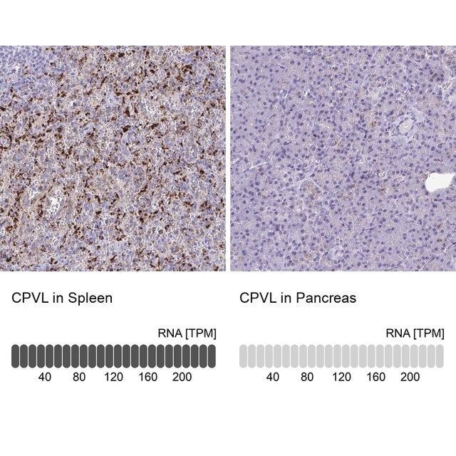 Anti-CPVL antibody produced in rabbit