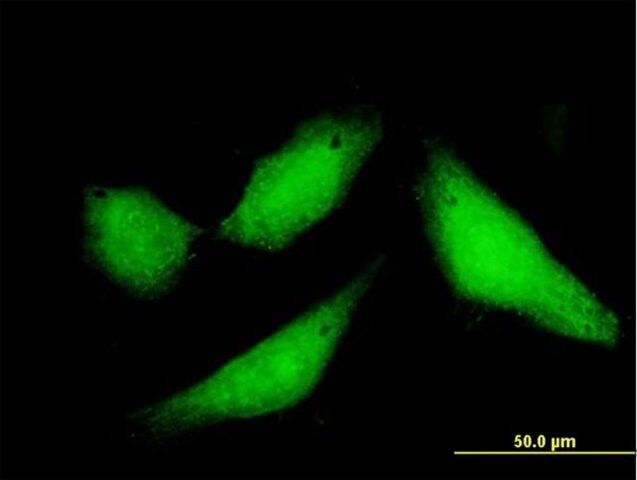 Anti-CPXCR1 antibody produced in mouse